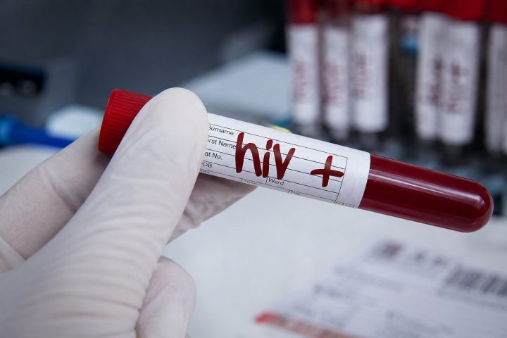 Fiji HIV Outbreak Hits Record as New Cases Surge and Treatment Gaps Grow